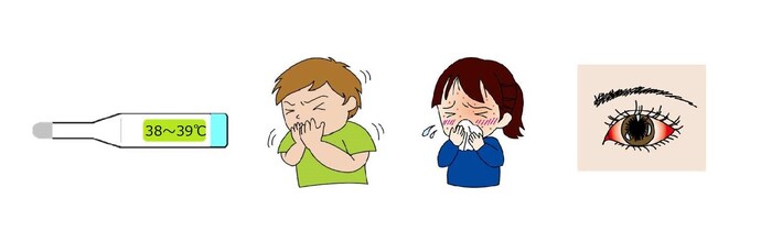 麻しんの代表的な症状は発熱、咳、鼻水、発疹、目の充血です。