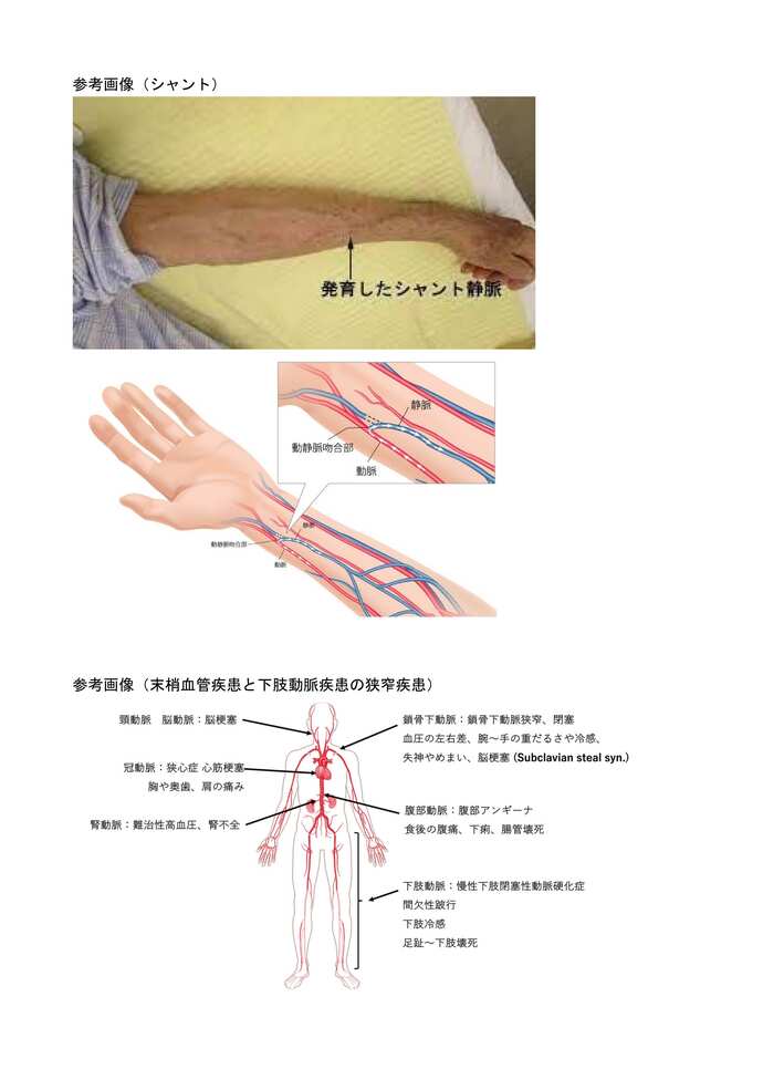 参考画像